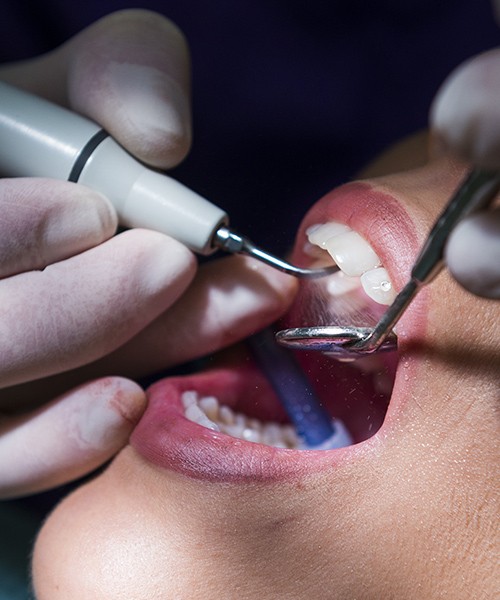Clínica Dentária Morgado - Higiene Oral