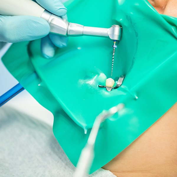 ENDODONTIA MECANIZADA